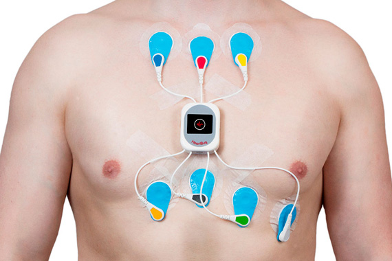 24 hour Holter monitoring